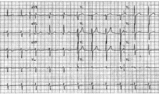 女生做心电图遇到男医生