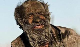 全球最脏的人洗澡后去世